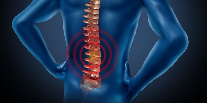 Οστεοχονδρία της οσφυϊκής περιοχής